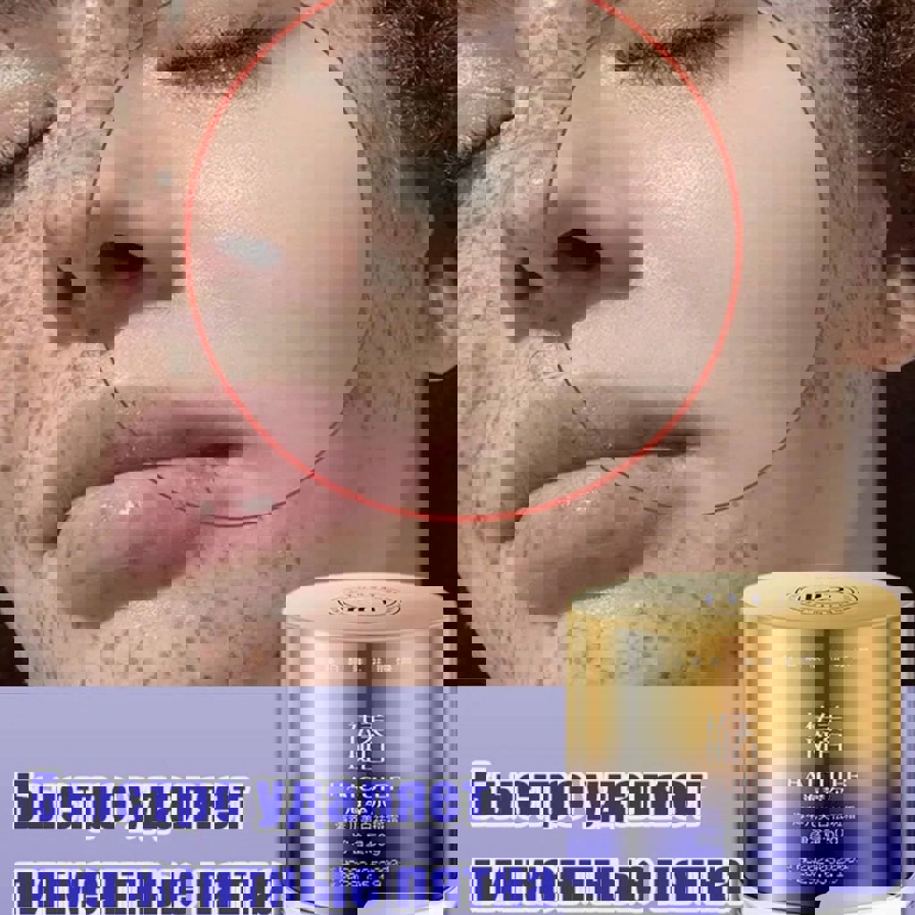 Крем от пигментации и веснушек