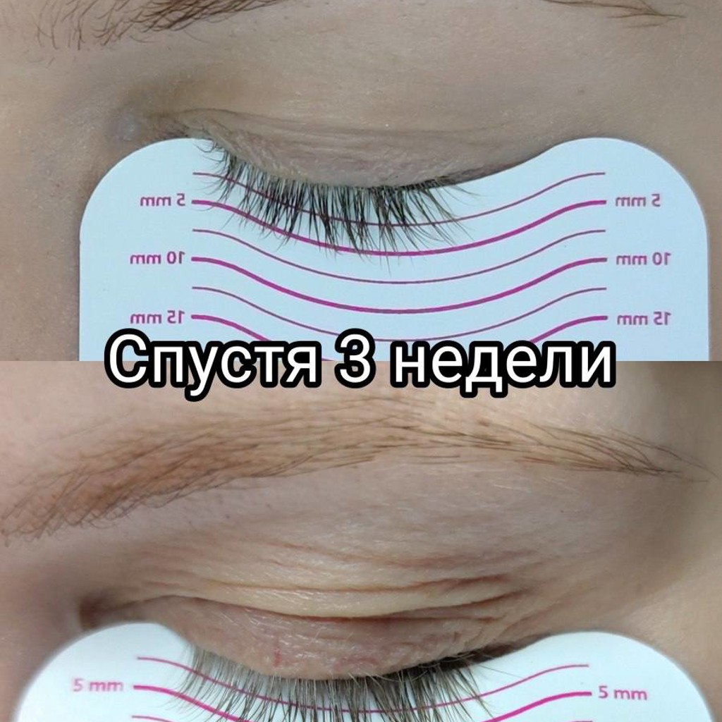 Сыворотка для роста ресниц