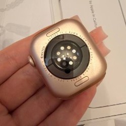 Apple Watch Series 11 - фото 4