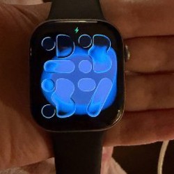 Apple Watch Series 11 - фото 4