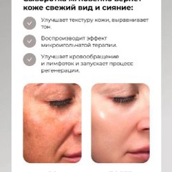 CICA Reedle Shot 700 - фото 6