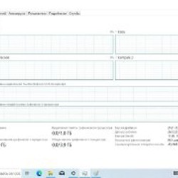 Ноутбук Acer E1-571G - фото 3